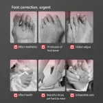 Bone Thumb Adjuster Orthotics Toe Straightener Foot Care